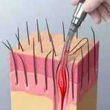 Hair Transplant Cost Guide